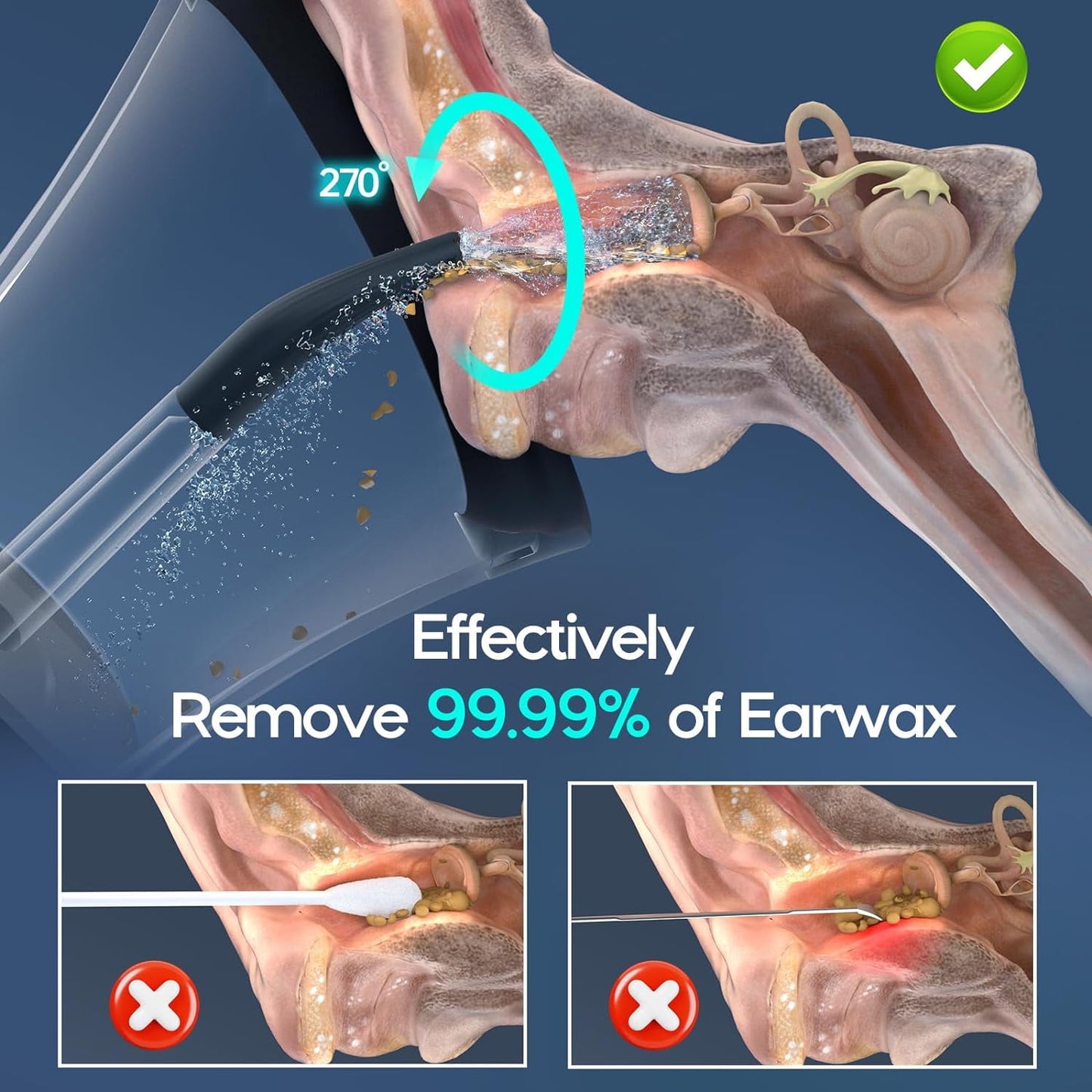 Morfone Ear Wax Removal, Intelligent Ear Cleaning Kit, Ear Cleaner with 4 Pressure Modes, IPX6 Waterproof, Safe Ear Irrigation Flushing System for Earwax Buildup (Black)