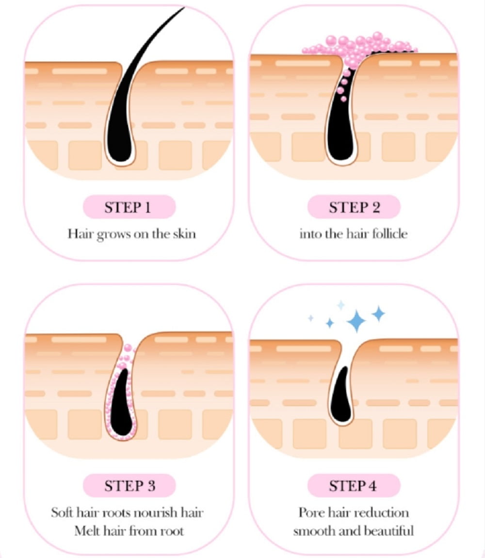 Hopy Hair Removal Cream- Aloe Vera, Vitamin E, and Olive Oil - Intimate - Body Legs Arms Underarms - Skin Friendly - 50g